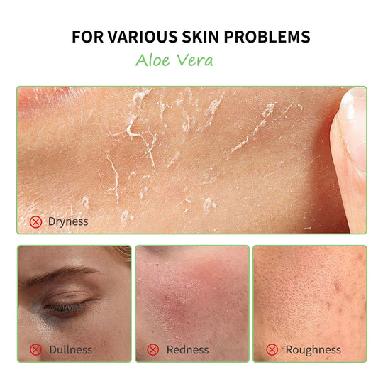 Multi-skin Care Aloe Vera Skin Care Set Deep Moisturizing Deep Nourishment Whitening Brightening Hydrating Smooth Skin