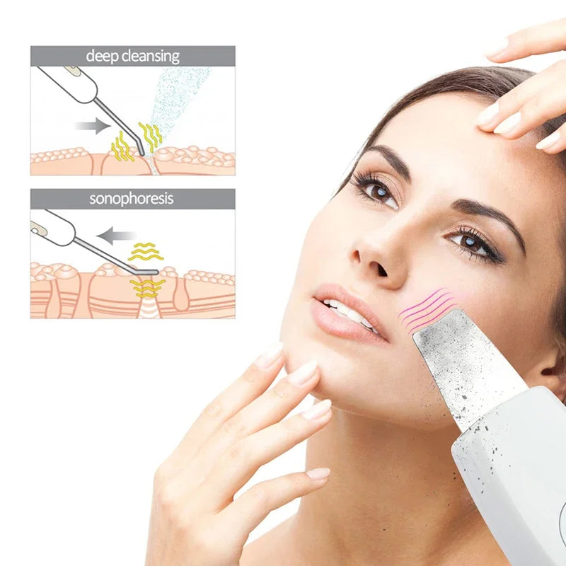 Acne Blackhead Remover